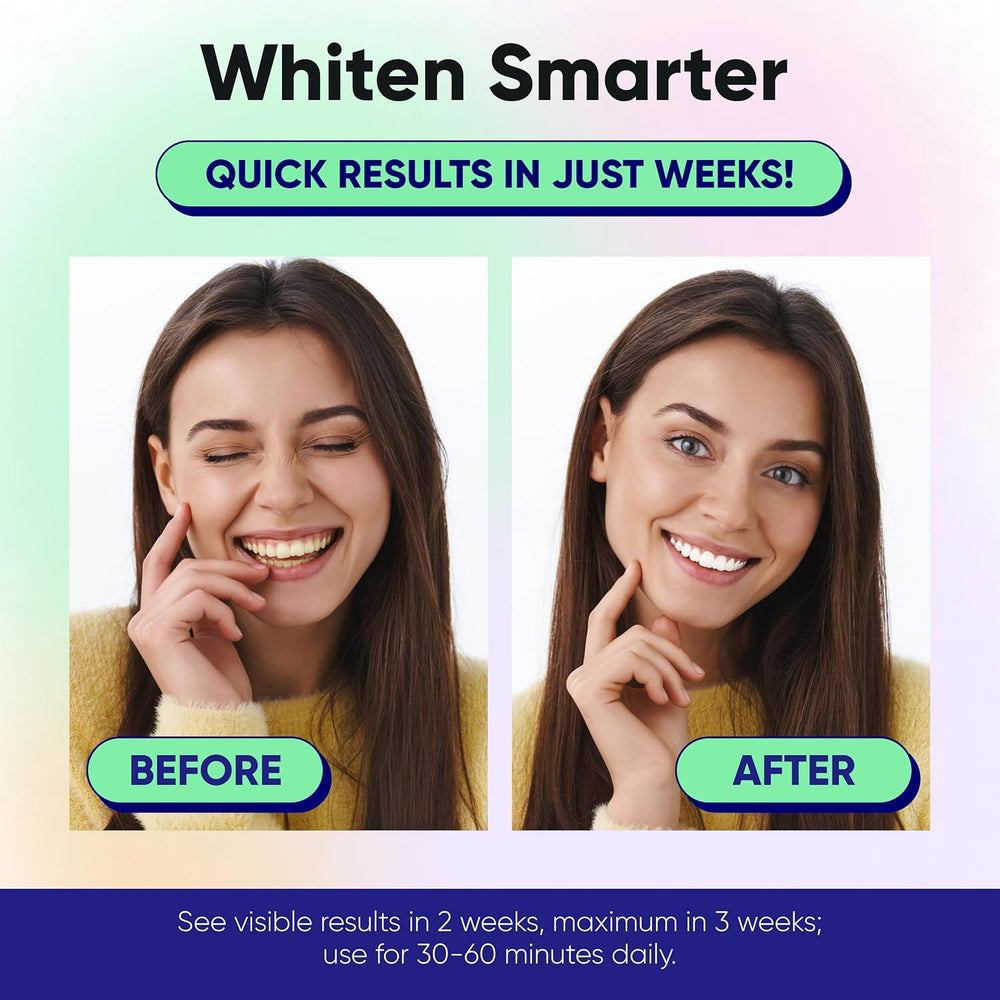 Bright Smile | Teeth Whitening Strips