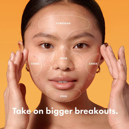 Mighty Clear Skin Patches | Pimple Patch