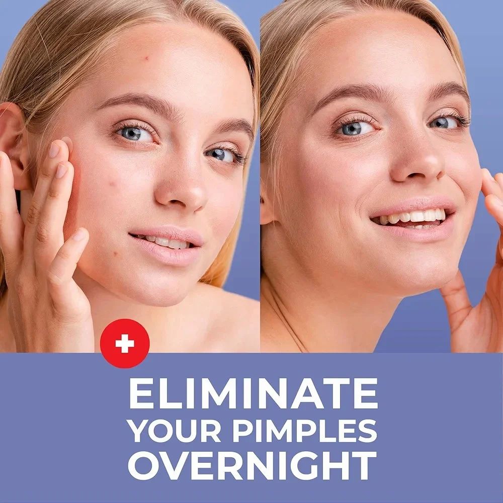 Mighty Clear Skin Patches | Pimple Patch